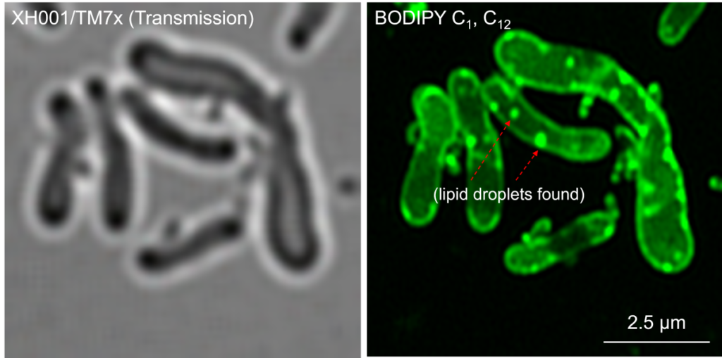 Dr. Dong discovered the lipid droplets in the coculture system XH001/TM7x by super-resolution fluorescence imaging. Image courtesy of Pu-Ting Dong.